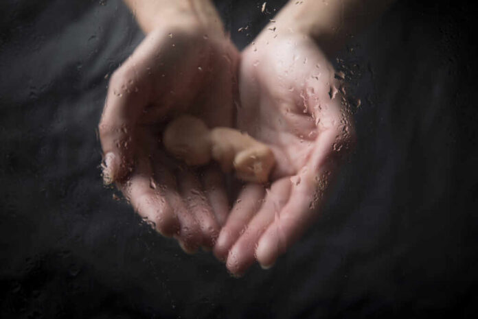 Death,Of,An,Unborn,Child