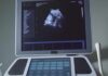 After birthright citizenship ruling, Texas Republicans scrutinize surrogacy and birth tourism