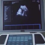 After birthright citizenship ruling, Texas Republicans scrutinize surrogacy and birth tourism