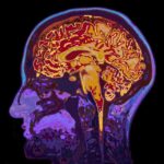 Human brain MRI side profile with colorful scan overlay