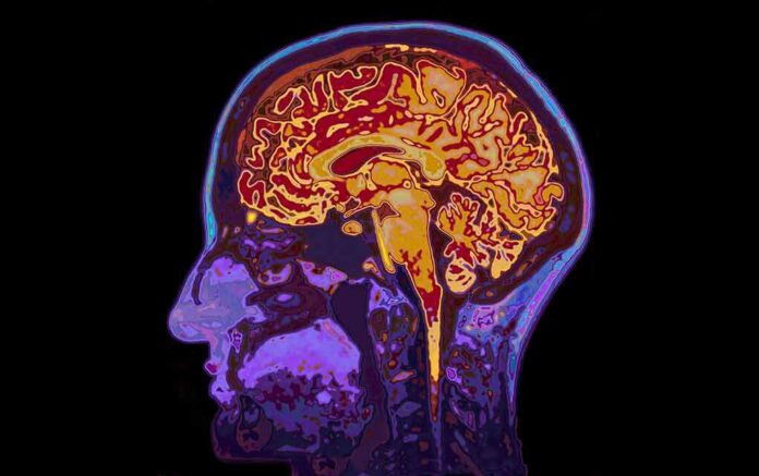 Human brain MRI side profile with colorful scan overlay